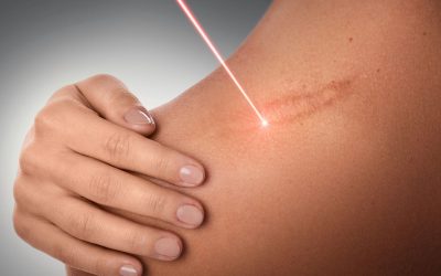 Cuidado con los centros de estética.